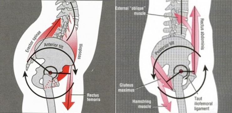 anteriorpelvictilt.jpg